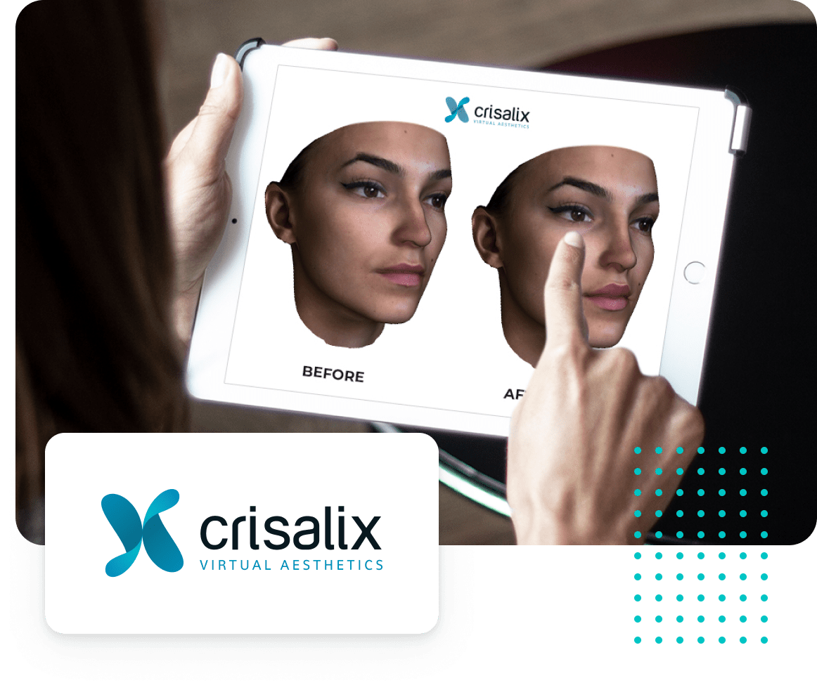 Crisalix app